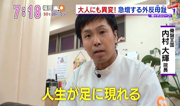 2016年9月8日　KBCアサデス　大人にも異変急増する外反母趾