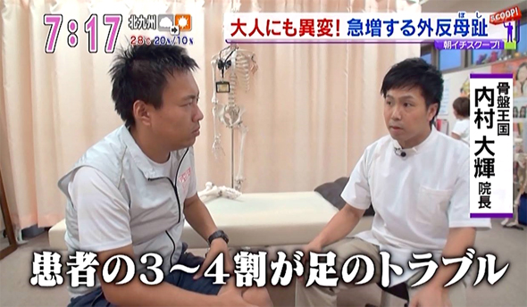 2016年9月8日　KBCアサデス　大人にも異変急増する外反母趾