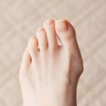 外反母趾の本当の原因とは？