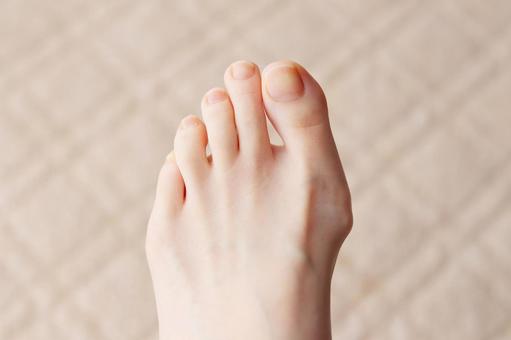 外反母趾の本当の原因とは？