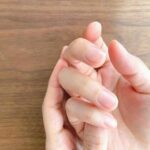 手のしびれの原因？手根管症候群について