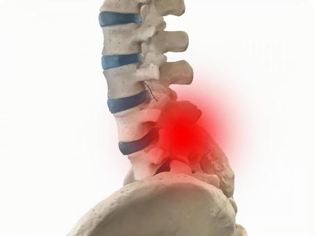 成長期に多い腰椎分離症とは？原因と対策